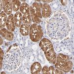 Aldolase B Antibody in Immunohistochemistry (IHC)