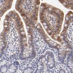 Aldolase B Antibody in Immunohistochemistry (IHC)