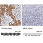 Aldolase B Antibody