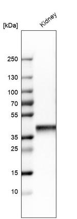 Aldolase B Antibody in Western Blot (WB)