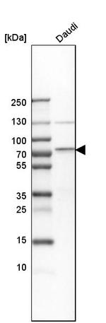 cIAP2 Antibody in Western Blot (WB)