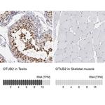 OTUB2 Antibody in Immunohistochemistry (IHC)