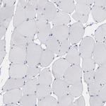 OTUB2 Antibody in Immunohistochemistry (IHC)