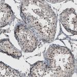 KIAA0020 Antibody in Immunohistochemistry (IHC)