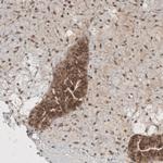 KIAA0020 Antibody in Immunohistochemistry (IHC)