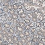 KIAA0020 Antibody in Immunohistochemistry (IHC)