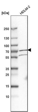 KIAA0020 Antibody in Western Blot (WB)