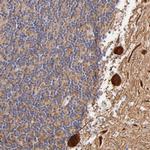 BTG2 Antibody in Immunohistochemistry (Paraffin) (IHC (P))