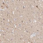 BTG2 Antibody in Immunohistochemistry (Paraffin) (IHC (P))