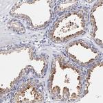 BTG2 Antibody in Immunohistochemistry (Paraffin) (IHC (P))