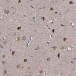 CARS Antibody in Immunohistochemistry (IHC)