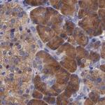 CARS Antibody in Immunohistochemistry (IHC)