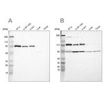 CARS Antibody in Western Blot (WB)