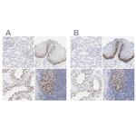 NCAPH Antibody in Immunohistochemistry (IHC)