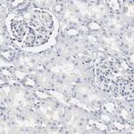 NCAPH Antibody in Immunohistochemistry (IHC)