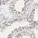 NCAPH Antibody in Immunohistochemistry (IHC)