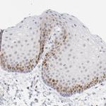 NCAPH Antibody in Immunohistochemistry (IHC)