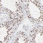 NCAPH Antibody in Immunohistochemistry (IHC)