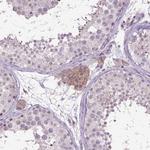 Carboxypeptidase M Antibody in Immunohistochemistry (Paraffin) (IHC (P))