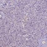 Carboxypeptidase M Antibody in Immunohistochemistry (Paraffin) (IHC (P))