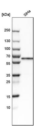 Carboxypeptidase M Antibody in Western Blot (WB)