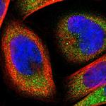 FTSJ1 Antibody in Immunocytochemistry (ICC/IF)