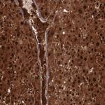 FTSJ1 Antibody in Immunohistochemistry (Paraffin) (IHC (P))