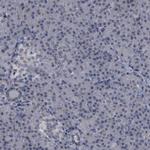 BAZ1A Antibody in Immunohistochemistry (Paraffin) (IHC (P))