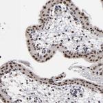 BAZ1A Antibody in Immunohistochemistry (Paraffin) (IHC (P))