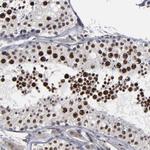 BAZ1A Antibody in Immunohistochemistry (Paraffin) (IHC (P))