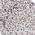 ZNF544 Antibody in Immunohistochemistry (Paraffin) (IHC (P))