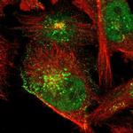 NAB1 Antibody in Immunocytochemistry (ICC/IF)