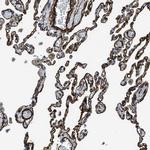 NAB1 Antibody in Immunohistochemistry (IHC)