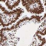 FBXO18 Antibody in Immunohistochemistry (Paraffin) (IHC (P))