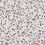 FBXO18 Antibody in Immunohistochemistry (Paraffin) (IHC (P))