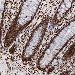 FBXO18 Antibody in Immunohistochemistry (Paraffin) (IHC (P))