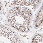 SSBP1 Antibody in Immunohistochemistry (IHC)