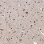 SSBP1 Antibody in Immunohistochemistry (IHC)