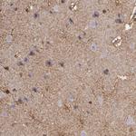 NDRG2 Antibody in Immunohistochemistry (Paraffin) (IHC (P))