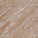 NDRG2 Antibody in Immunohistochemistry (Paraffin) (IHC (P))