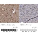 NDRG2 Antibody in Immunohistochemistry (IHC)