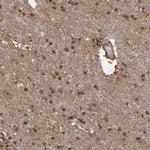 NDRG2 Antibody in Immunohistochemistry (IHC)