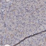 NDRG2 Antibody in Immunohistochemistry (IHC)