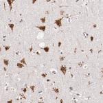 BEGAIN Antibody in Immunohistochemistry (Paraffin) (IHC (P))