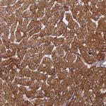 PHKA2 Antibody in Immunohistochemistry (Paraffin) (IHC (P))