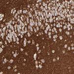 GPM6B Antibody in Immunohistochemistry (Paraffin) (IHC (P))