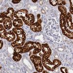 ENTPD5 Antibody in Immunohistochemistry (Paraffin) (IHC (P))