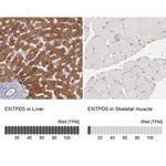 ENTPD5 Antibody in Immunohistochemistry (IHC)