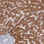 ENTPD5 Antibody in Immunohistochemistry (IHC)