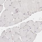 ENTPD5 Antibody in Immunohistochemistry (IHC)